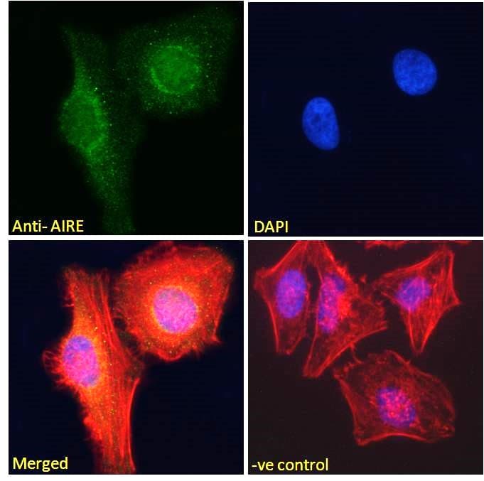 IHC-plus™ AIRE Antibody (aa534-545)