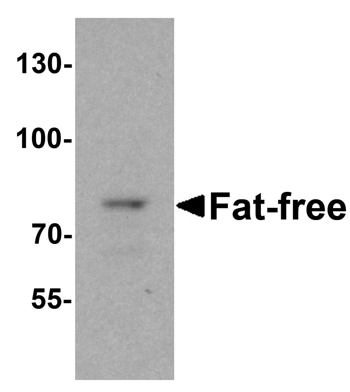 IHC-plus™ C11orf2 / Fat-Free Antibody