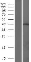 ATXN3L Protein (Over-Expression Lysate Myc-DDK (Flag))