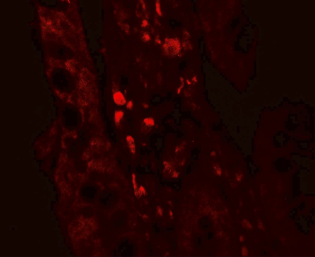 GLIPR1 / GLIPR Antibody