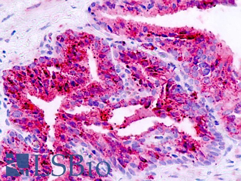 IHC-plus™ ADGRB1 / BAI1 Antibody (N-Terminus)