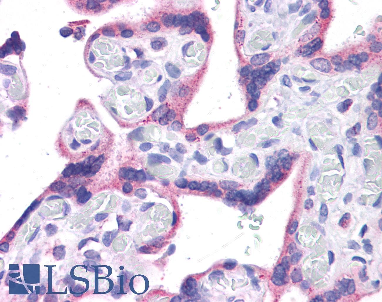 IHC-plus™ WT1 / Wilms Tumor 1 Antibody (aa396-448)