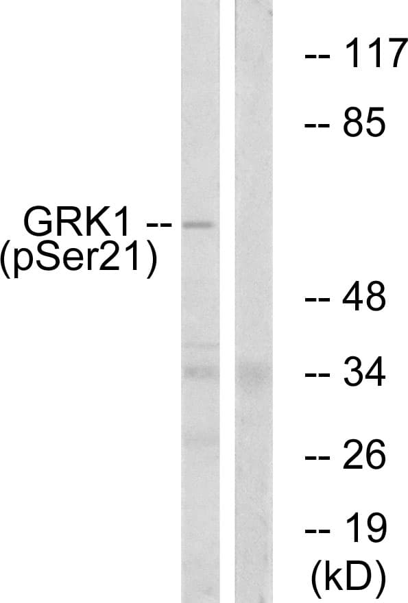 Rhodopsin Kinase / GRK1 Antibody (phospho-Ser21)