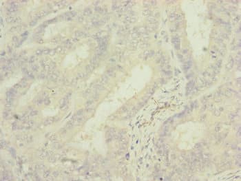 MRPS6 / MRP S6 Antibody