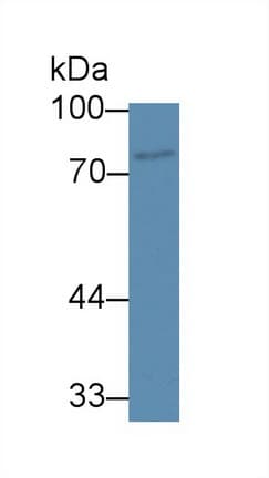 ABCB8 Antibody