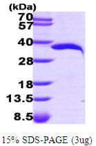 Human NMNAT1 / NMNAT Protein (Recombinant His)