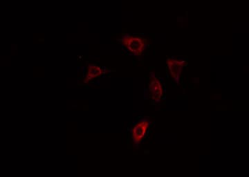 Polyclonal Rabbit anti-Human PPP1R3C / PTG Antibody (IF, WB)