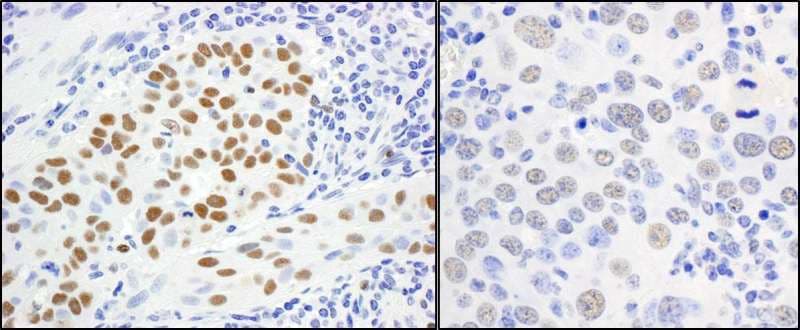 Polyclonal Rabbit anti-Human MCM5 Antibody (aa1-50, IHC, WB)