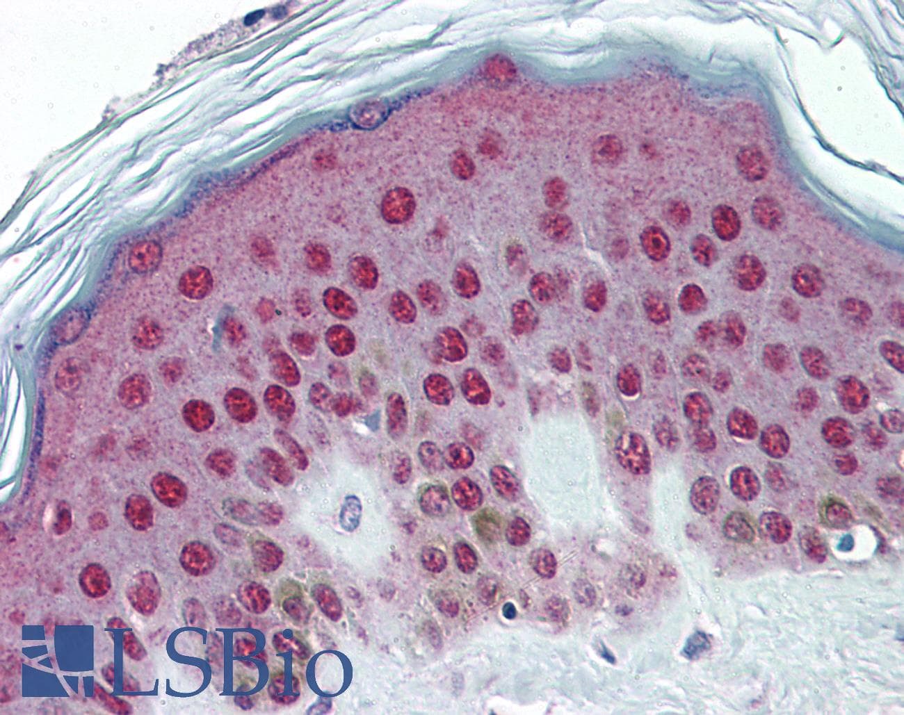 PathPlus™ Monoclonal Mouse anti-Human TFAP2A / AP-2 Antibody (clone 2G5, IHC, WB)