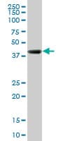 RNF2 / RING2 / RING1B Antibody (clone 3G6)