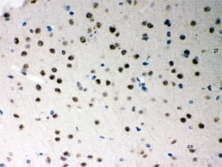 SRSF1 / SF2 Antibody
