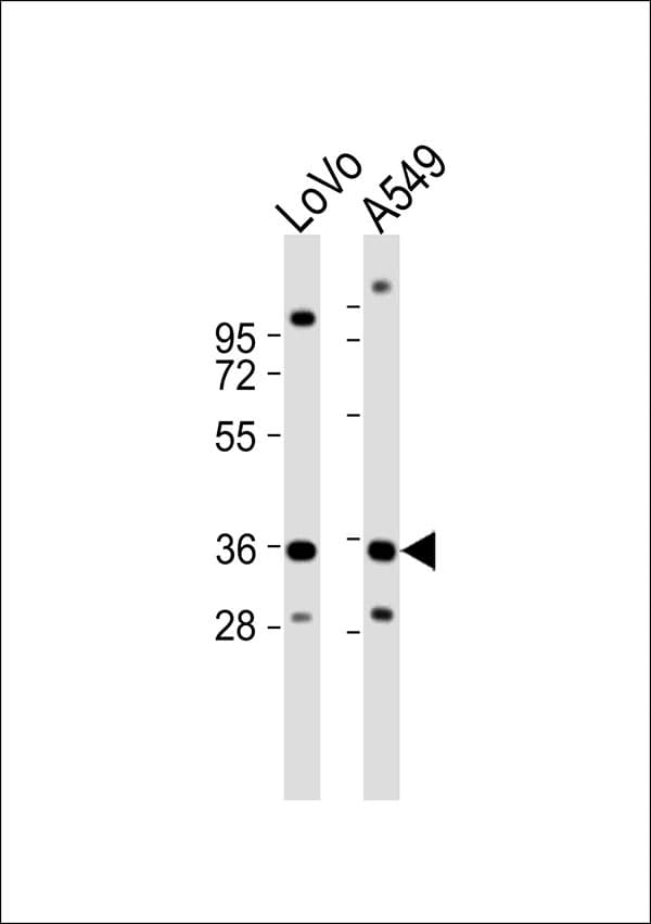 Polyclonal Rabbit anti-Human HOXB2 Antibody (WB)