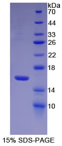 Human P450SCC / CYP11A1 Protein (Recombinant His-T7)