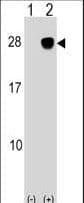 Polyclonal Rabbit anti-Human ULBP2 / RAET1H Antibody (aa88-116, WB)