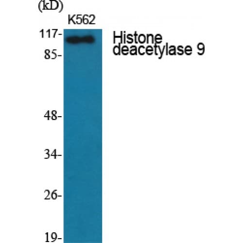 HDAC9 Antibody (980-1060 aa, C-terminal)
