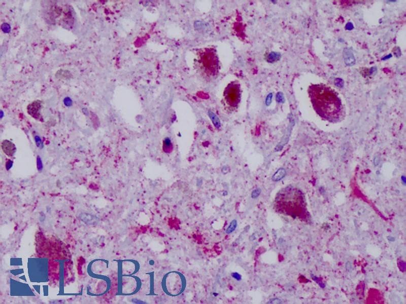 IHC-plus™ NPY4R / PPYR1 Antibody (Cytoplasmic Domain)