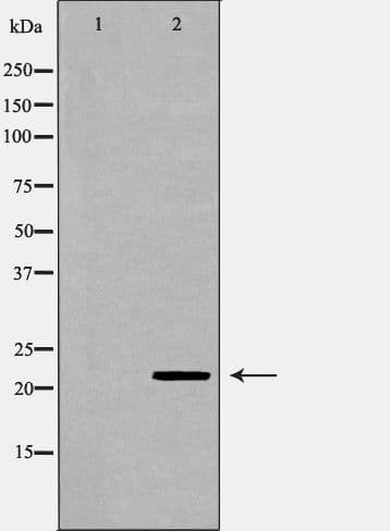 GPX1 / Glutathione Peroxidase Antibody
