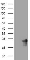 VILIP / VSNL1 Antibody (aa2-191, clone OTI2B10)