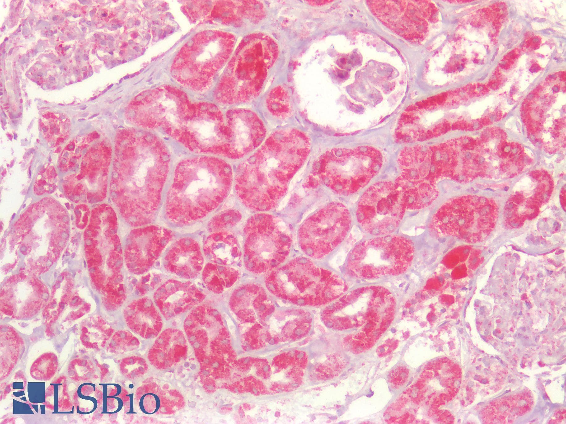 PathPlus™ SDHB Antibody (aa1-150)