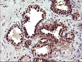 Monoclonal Mouse anti-Human UPRT Antibody (clone OTI1C9, IHC, WB)