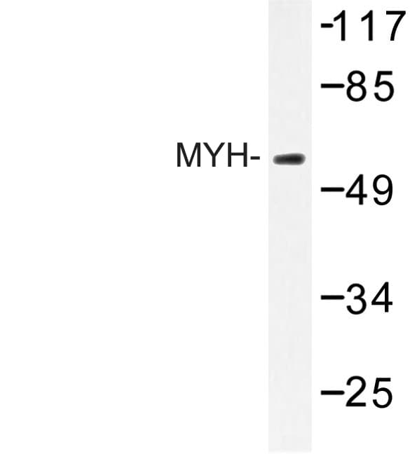 MUTYH / MYH Antibody (Tyr176)