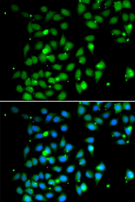 HMG1 / HMGB1 Antibody
