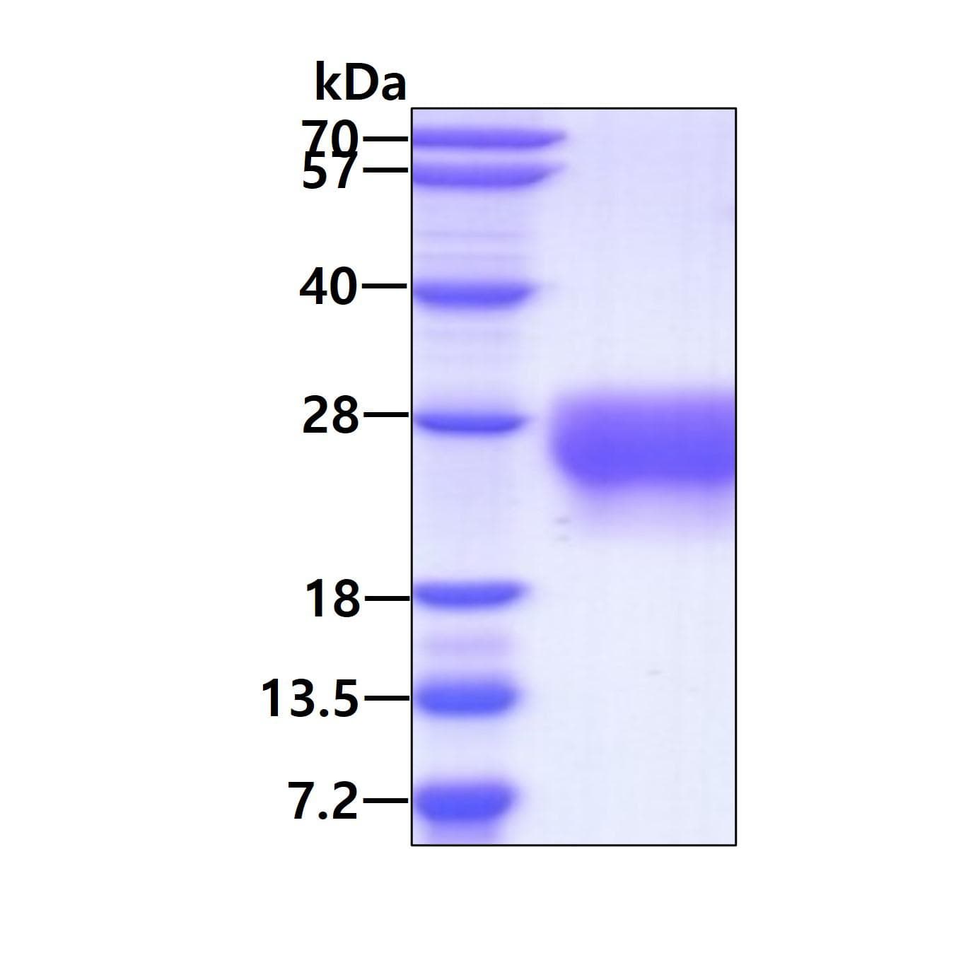 Human OSTN / Musclin / Osteocrin Protein (Recombinant His)