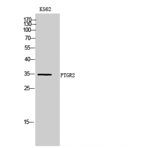 Polyclonal Rabbit anti-Human PTGR2 / PGR2 Antibody (150-230 aa, Internal, IHC, WB)