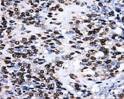 Monoclonal Mouse anti-Human LOX / Lysyl Oxidase Antibody (clone OTI6B11, IHC, IF, WB)