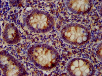 Polyclonal Rabbit anti-Human VPS52 / SACM2L Antibody (IHC)