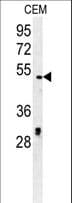 Polyclonal Rabbit anti-Human DCC1 / DSCC1 Antibody (aa311-339, WB)