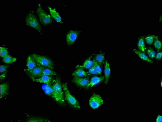 PRKCZ / PKC-Zeta Antibody