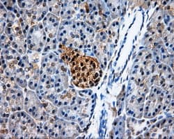 PSMC3 Antibody (clone OTI8D6)