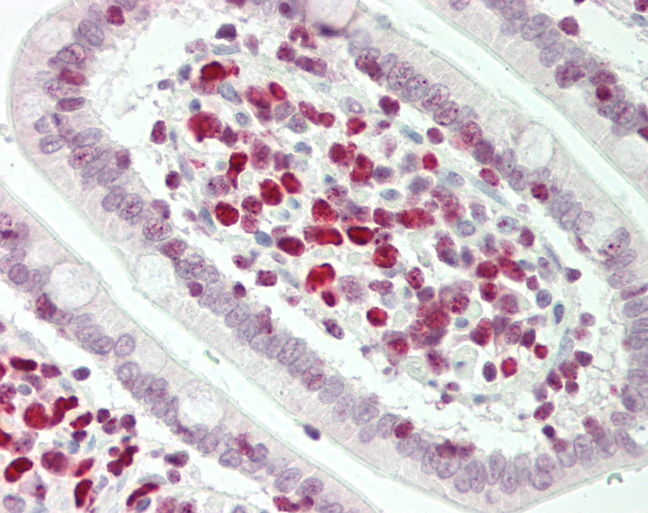 IHC-plus™ TERF2 / TRF2 Antibody