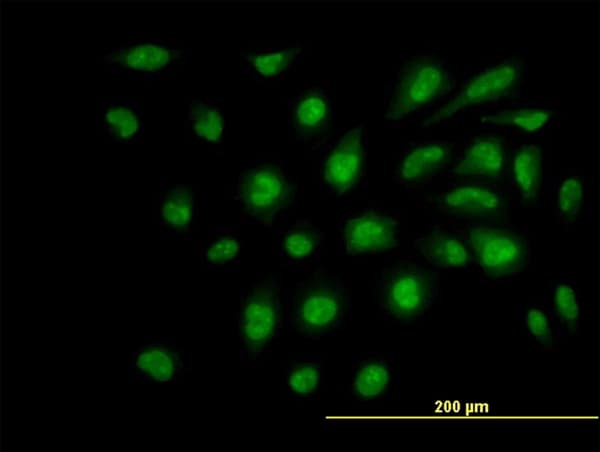 Monoclonal Mouse anti-Human SPT5 / SUPT5H Antibody (clone 3F1, IHC, IF, WB)