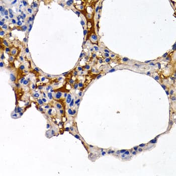 CYP24 / CYP24A1 Antibody