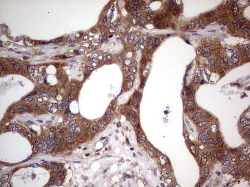 BFSP2 Antibody (aa184-415, clone OTI4E7, Carrier-free)