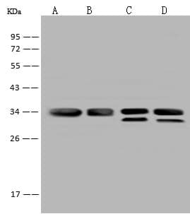 Polyclonal Rabbit anti-Human VDAC2 Antibody (IHC, IF, WB)