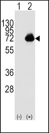 Polyclonal Rabbit anti-Human ACOX1 / ACOX Antibody (aa629-659, WB)