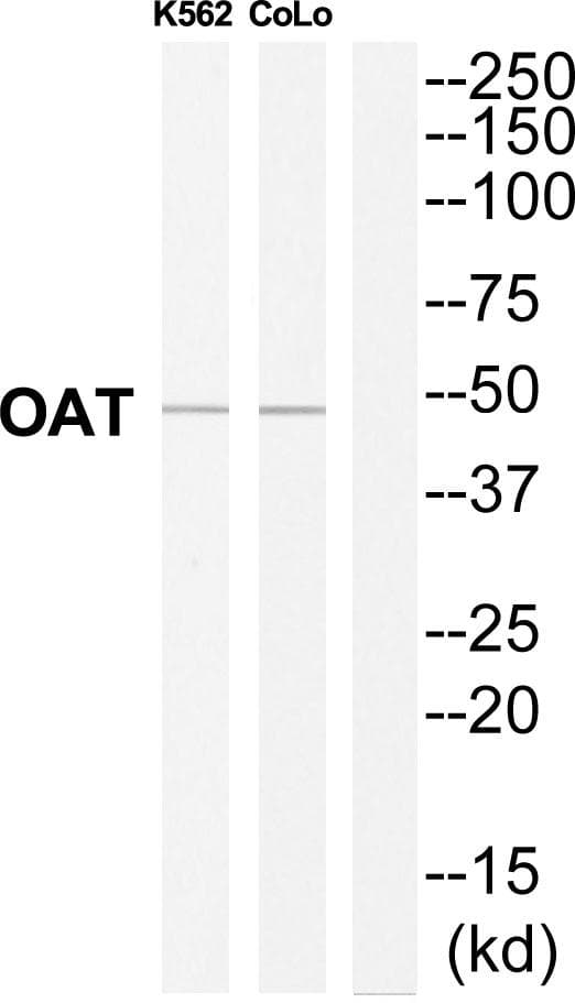 Polyclonal Rabbit anti-Human OAT Antibody (WB)