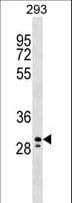 PEF1 Antibody (aa95-121)