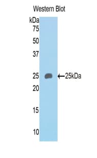 SEMA4B / Semaphorin 4B Antibody (aa31-240)