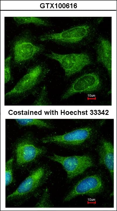IHC-plus™ YES1 / c-Yes Antibody