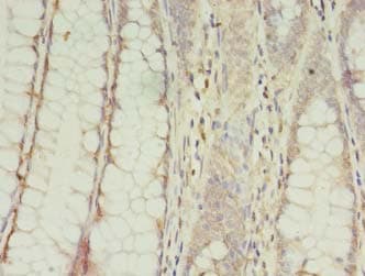 CPNE9 Antibody
