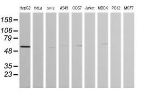 ZSCAN21 / Zipro1 Antibody (clone OTI2E5)