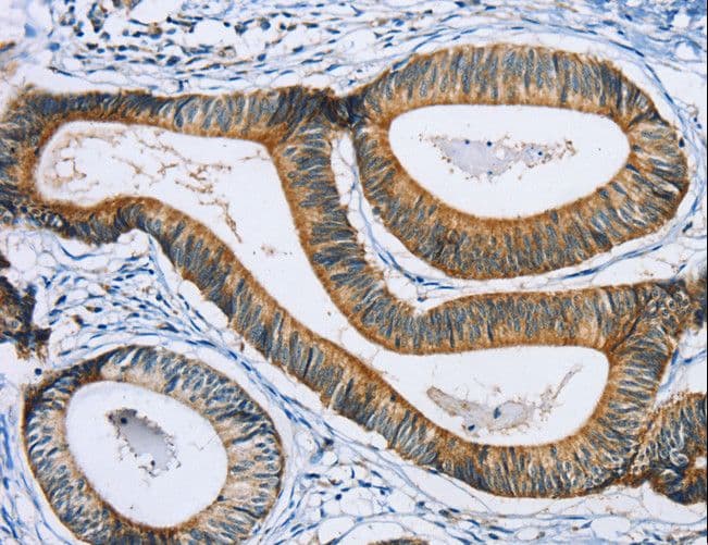 Polyclonal Rabbit anti-Human SULT1B1 / Sulfotransferase 1B1 Antibody (IHC, WB)