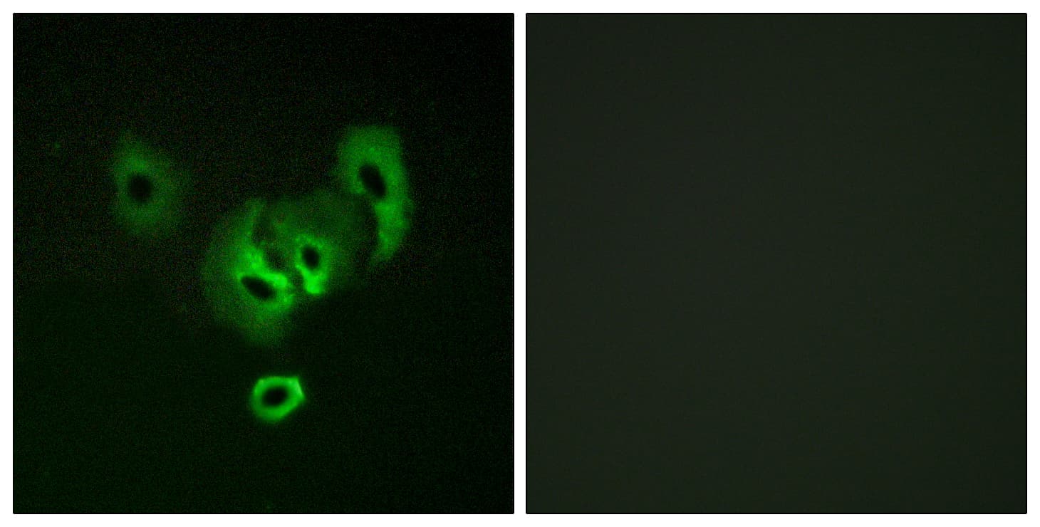 STEAP2 Antibody (aa431-480)