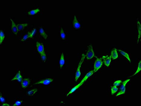 SH2D1A / SAP Antibody