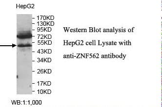 Polyclonal Rabbit anti-Human ZNF562 Antibody (aa152-414, IHC, WB)