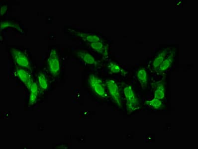 Polyclonal Rabbit anti-Human SMARCAL1 Antibody (IF, WB)